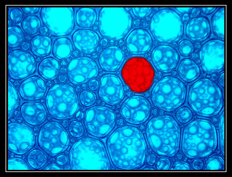 Virus